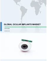 Global Ocular Implants Market 2018-2022